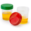 Specimen Container, 4oz, with Full Turn Red Separate Screwcap, Frosted Non-Sterile, Graduated-5905R