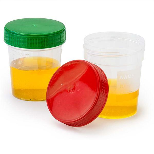 Specimen Container, 4oz, with Full Turn Red Separate Screwcap, Frosted Non-Sterile, Graduated-5905R