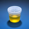 Specimen Container, 5oz. with Separate Snap Cap, Graduated-5917